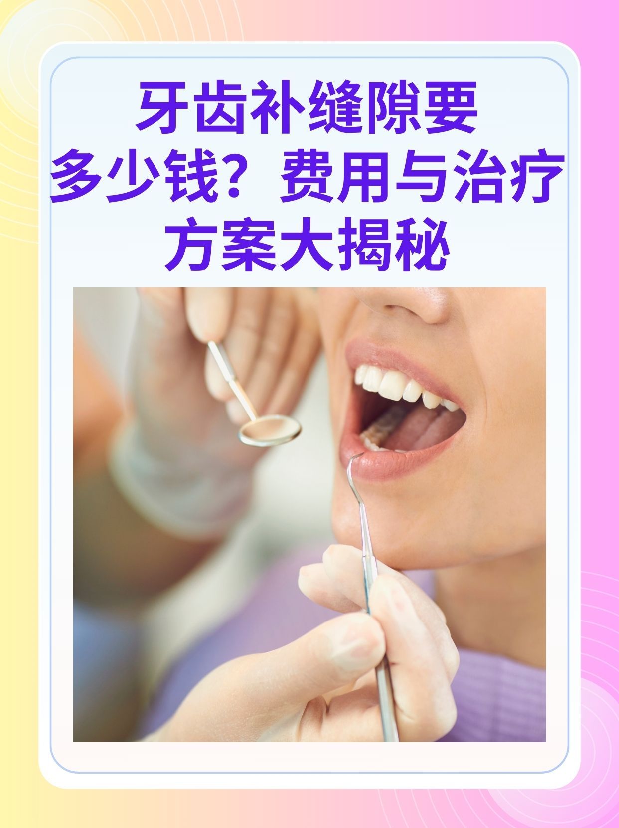 龙岩补牙医保可以报销吗(补牙医保可以报销吗 哪些可以报销呢)